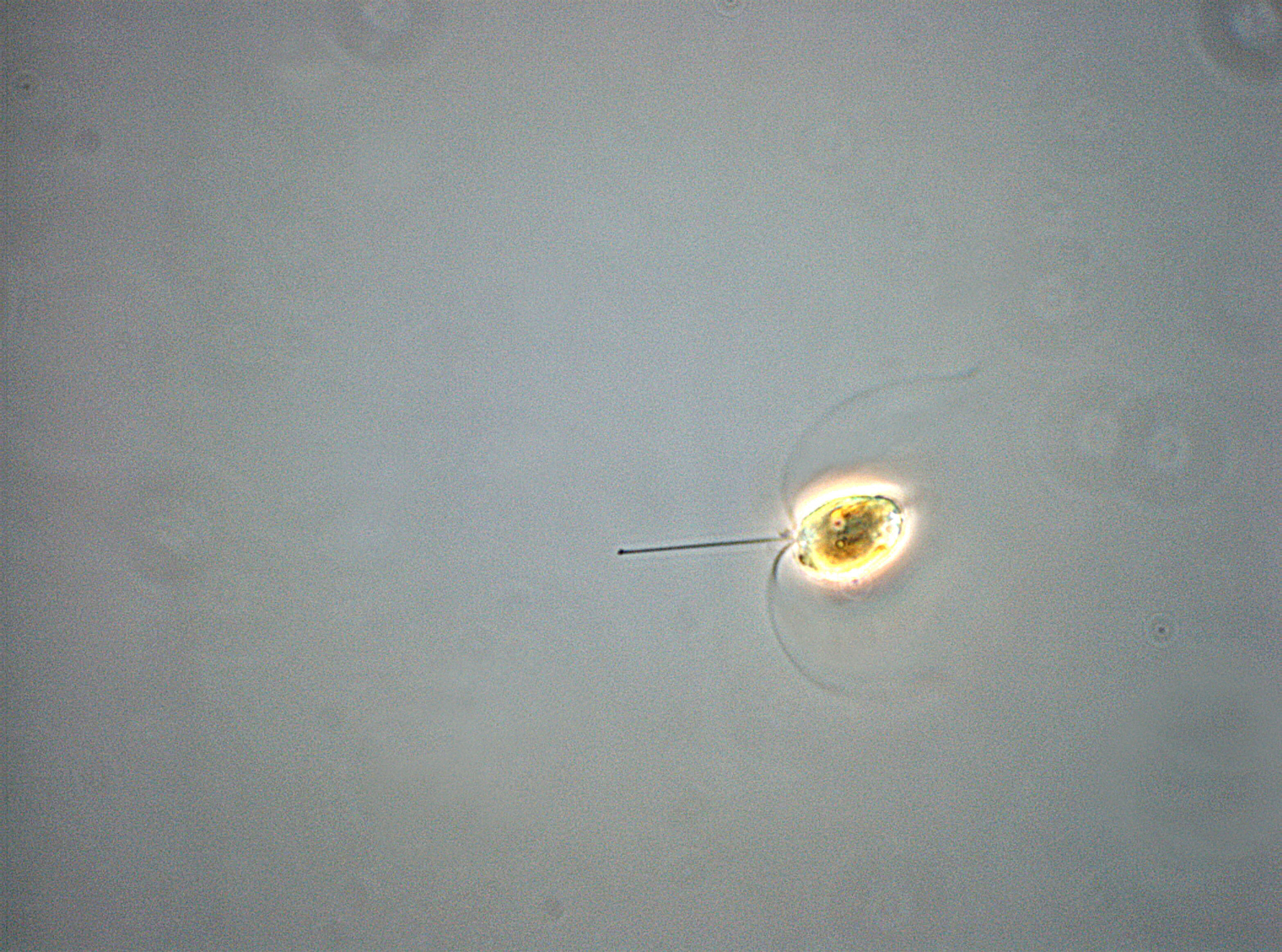 Gul klump med svarte streker stikkende ut, på grå bunn 