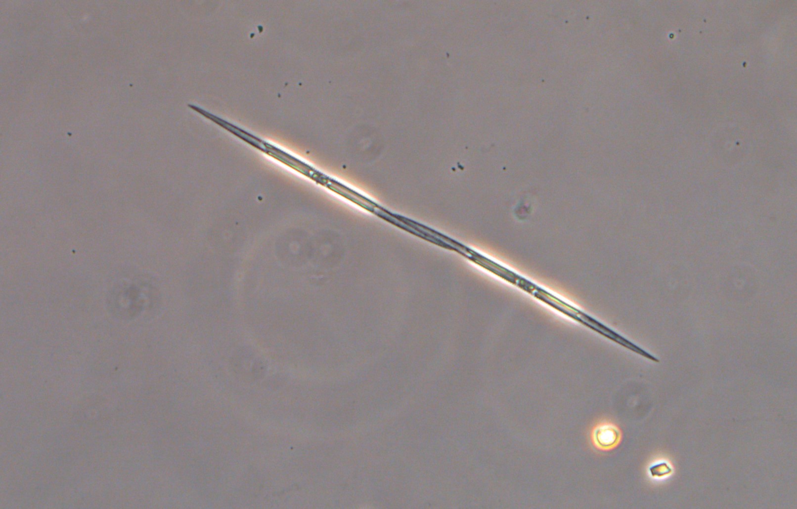 Et nålspiss-lignende plankton 