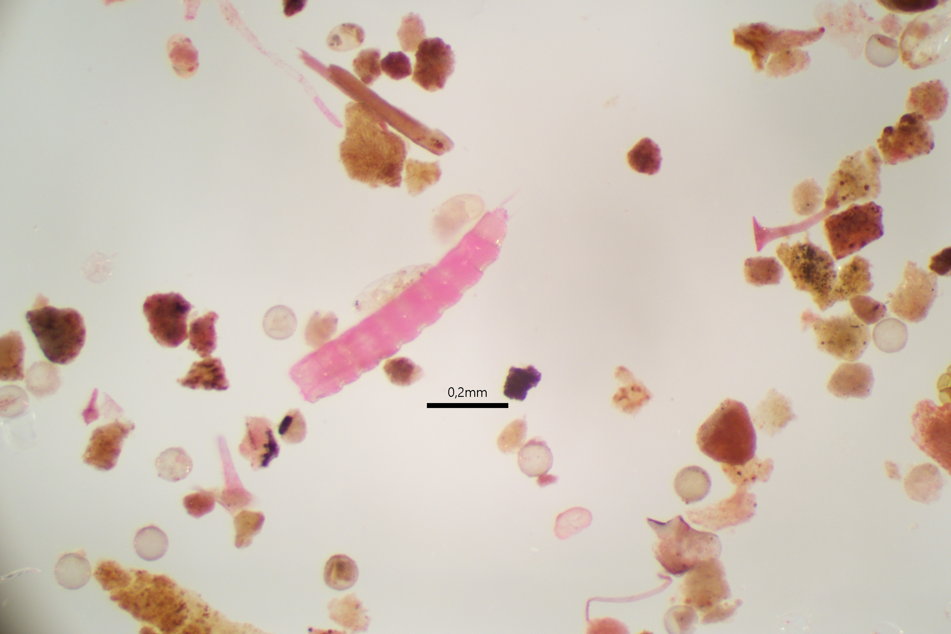 Mikroskopfoto av en liten pansermark fra sedimentene